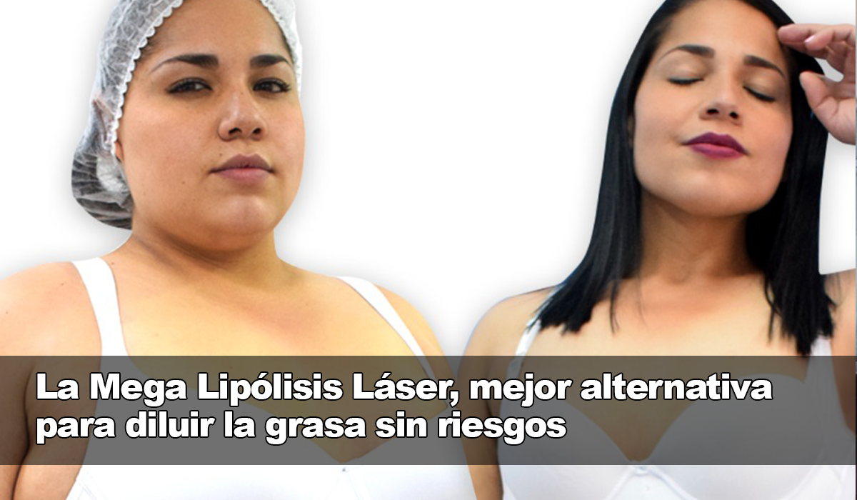 ¡Saluda a la grasa no deseada con la Mega Lipólisis Láser!